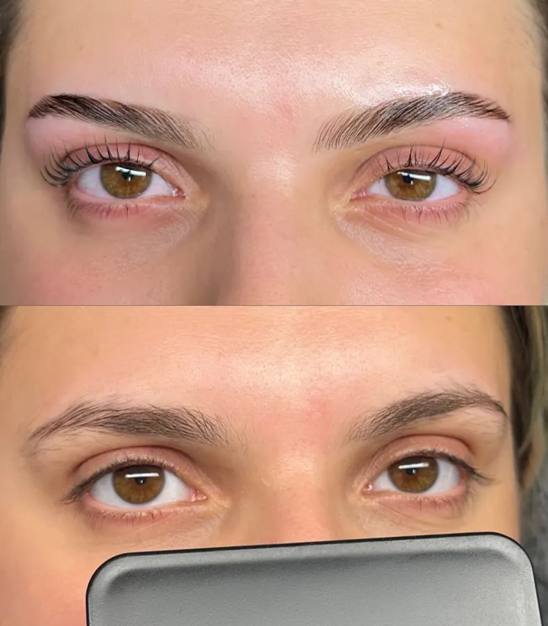 Vorher-Nachher: Wimpern-Lifting